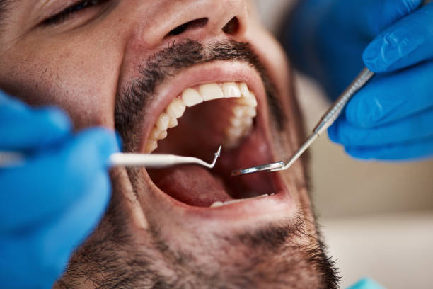 Best Emergency Cosmetic Dentistry (e.g., broken veneers) in South Wilton, CT